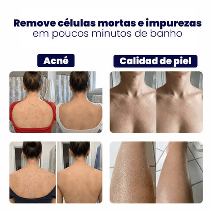SoftSkin Towel: Toalla Exfoliante - Elimina Impurezas y Células Muertas